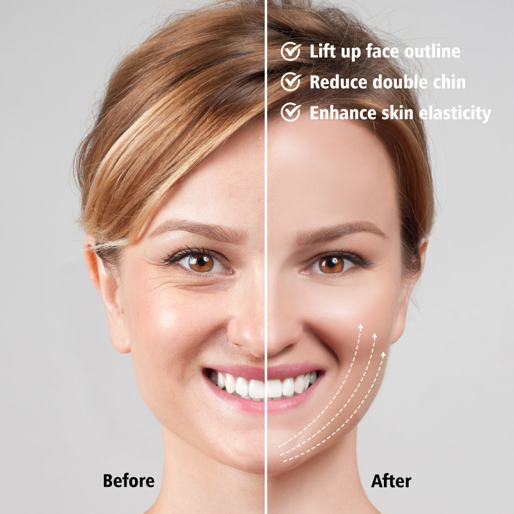 EMS Face Lifting Device LED Photon Therapy Vibration Facial Massager Face Slimm image 2